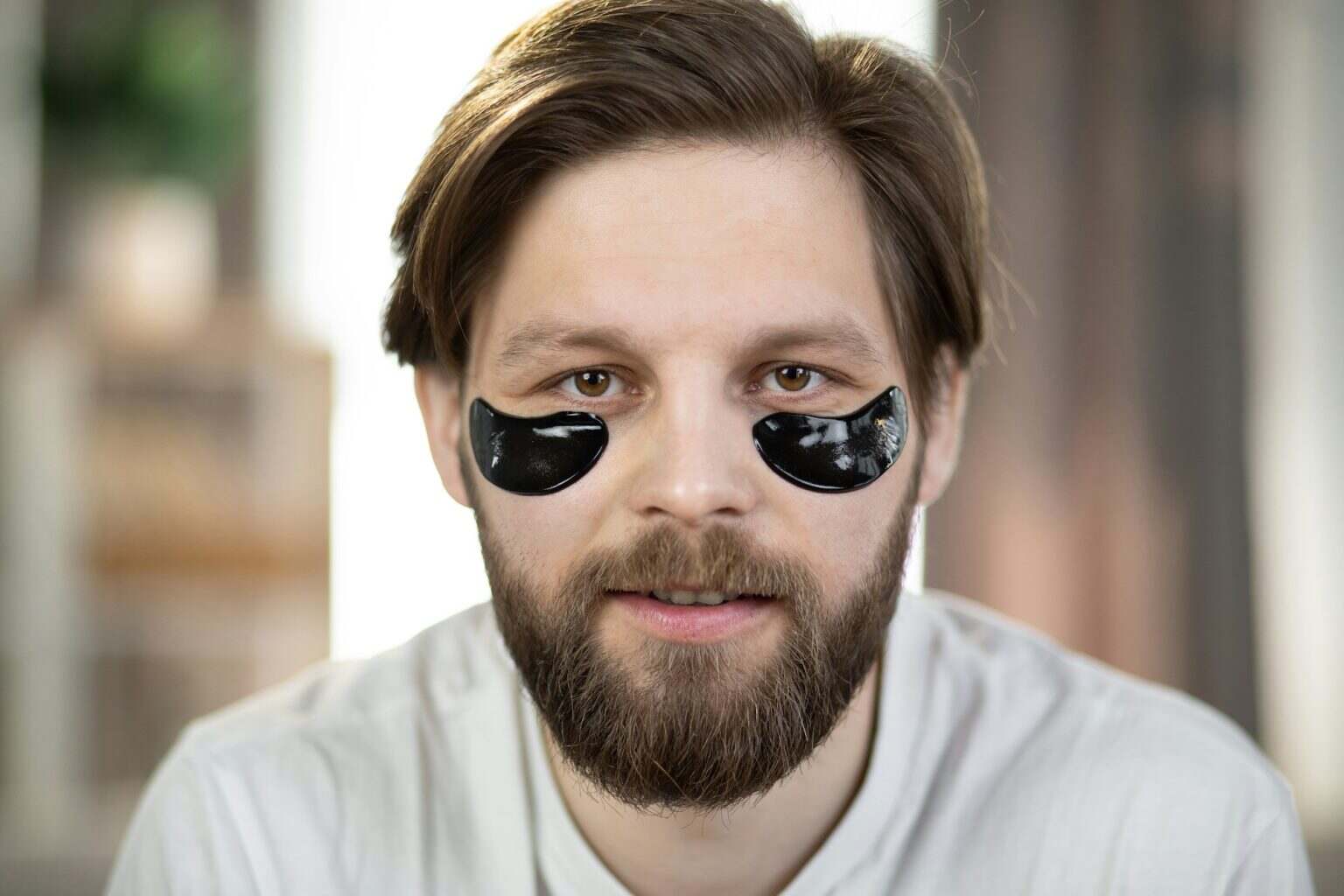 Caucasian man with black patches under eyes from wrinkles and dark circles