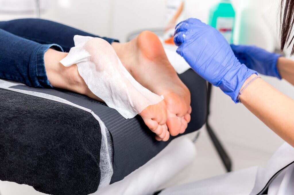 Peeling pour les pieds LOVASKIN : la solution pour des pieds doux et lisses Callus peel, peeling feet procedure at beauty salon